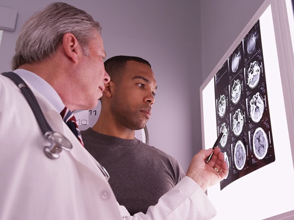 traumatic brain injury attorney alameda